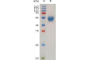 Human CD63 Protein, hFc Tag on SDS-PAGE under reducing condition. (CD63 Protein (CD63) (AA 103-203) (Fc Tag))