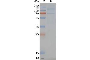 Human -Nanodisc, Flag Tag on SDS-PAGE (LGR6 Protein)