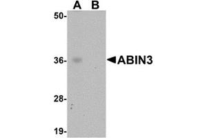 Western Blotting (WB) image for anti-TNFAIP3 Interacting Protein 3 (TNIP3) (C-Term) antibody (ABIN1030214) (TNIP3 antibody  (C-Term))