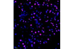 Immunofluorescence of paraffin embedded mouse pancreas using FUS (ABIN7075919) at dilution of 1:1000 (400x lens) (TLS/FUS antibody)