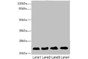 CRIP2 antibody  (AA 1-208)