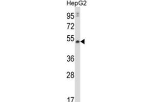 Western Blotting (WB) image for anti-Matrix Metalloproteinase 20 (MMP20) antibody (ABIN2997607) (MMP20 antibody)