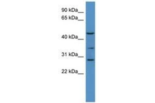 B3GALT2 antibody  (AA 352-401)