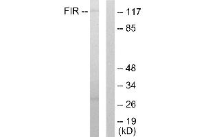 Western blot analysis of extracts from HuvEc cells, using FIR antibody. (FARP2 antibody  (Internal Region))