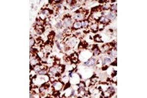 Image no. 2 for anti-GPI-anchor transamidase (GPI8) (C-Term) antibody (ABIN357726) (PIGK antibody  (C-Term))