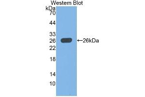 Western Blotting (WB) image for anti-Ubiquitin Carboxyl-terminal Esterase L1 (Ubiquitin Thiolesterase) (UCHL1) (AA 2-223) antibody (ABIN1078638) (UCHL1 antibody  (AA 2-223))