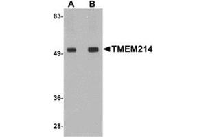 Western blot analysis of TMEM214 in rat brain tissue lysate with this product at (A) 1 and (B) 2 μg/ml. (TMEM214 antibody  (Center))