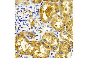 Immunohistochemistry of paraffin-embedded human kidney using CDK20 antibody (ABIN5971446) at dilution of 1/100 (40x lens). (CCRK antibody)