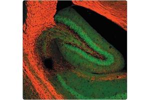 A tissue section through an adult Mouse brain showing MBP (red staining) of white matter tracts adjacent to the hippocampal formation. (MBP antibody)