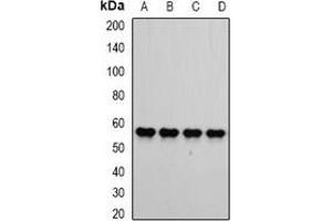 Western blot analysis of ATP5B expression in SW620 (A), HepG2 (B), mouse kidney (C), mouse brain (D) whole cell lysates. (ATP5B antibody)