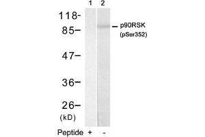 Western blot analysis of extracts from HUVEC cells using p90RSK(Phospho-Ser352) Antibody(Lane 2) and the same antibody preincubated with blocking peptide(Lane1). (RPS6KA1 antibody  (pSer352))