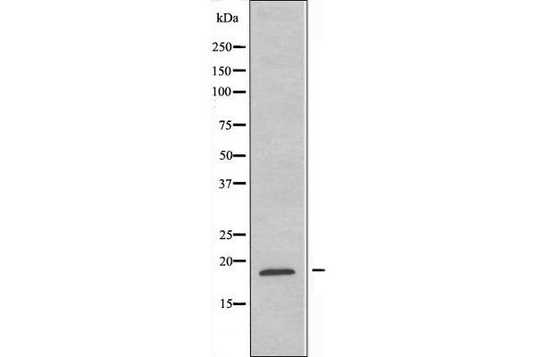 RPL12抗体（C-Term）