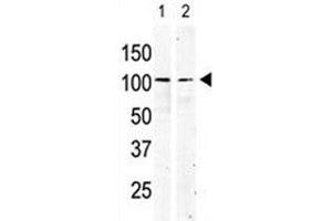 cKit antibody used in western blot to detect KIT in serum-starved HeLa cell lysate (lane 1) and primate testis tissue lysate (2). (KIT antibody  (AA 9-40))