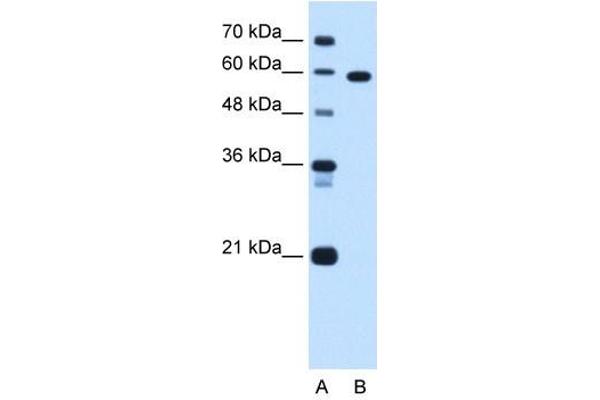 T-Box 15 antibody  (C-Term)