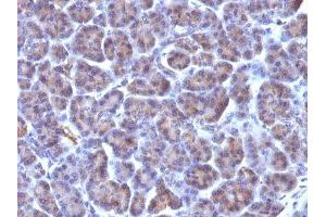 Image no. 1 for anti-Cytomegalovirus p65 (CMV p65) antibody (ABIN6152160) (CMV p65 antibody)