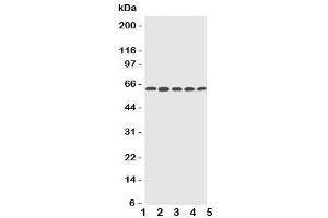 Western blot testing of CYP2U1 antibody and Lane 1:  HeLa (CYP2U1 antibody  (C-Term))