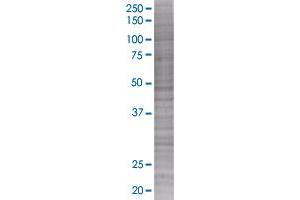 HIST1H1A transfected lysate (HIST1H1A 293T Cell Transient Overexpression Lysate(Denatured))