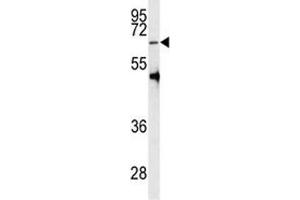 Western blot analysis of PRMT5 antibody and HL-60 lysate (PRMT5 antibody  (AA 473-499))