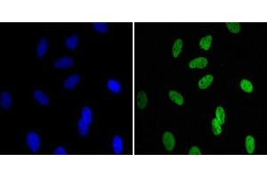 Immunofluorescence analysis of Hela cells using CBX1 mouse mAb (green). (CBX1 antibody)