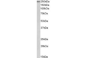 Western Blotting (WB) image for anti-Myosin 9 (MYH9) antibody (ABIN5903626) (Myosin 9 antibody)