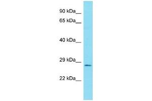 Host:  Rabbit  Target Name:  RELA  Sample Type:  Uterus Tumor lysate  Antibody Dilution:  1. (NF-kB p65 antibody  (N-Term))