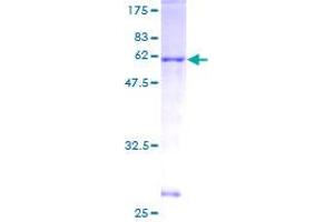 LAT Protein (AA 1-233) (GST tag)