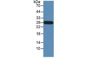 Western Blotting (WB) image for Granzyme M (Lymphocyte Met-Ase 1) (GZMM) ELISA Kit (ABIN6574157)