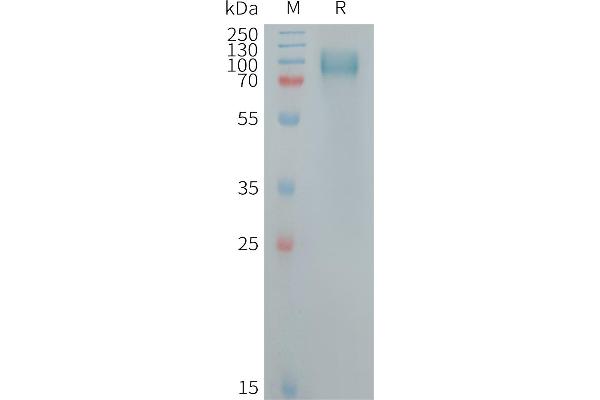 Osteoactivin Protein (GPNMB) (AA 23-496) (His tag)