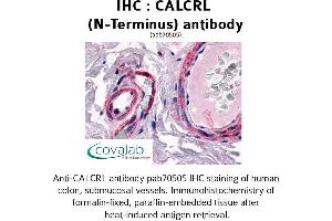 Image no. 1 for anti-Calcitonin Receptor-Like (CALCRL) (Extracellular Domain), (N-Term) antibody (ABIN1732561) (CALCRL antibody  (Extracellular Domain, N-Term))