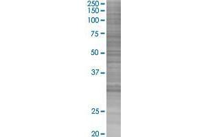 NAT9 transfected lysate. (NAT9 293T Cell Transient Overexpression Lysate(Denatured))