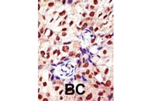 Immunohistochemistry (IHC) image for anti-Protein Arginine Methyltransferase 2 (PRMT2) antibody (ABIN2995499) (PRMT2 antibody)