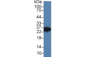 Western blot analysis of Rat Seminal vesicle lysate, using Rat DKKL1 Antibody (3 µg/ml) and HRP-conjugated Goat Anti-Rabbit antibody ( (Dickkopf-Like 1 (DKKL1) (AA 21-230) antibody)