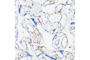 Immunohistochemistry of paraffin-embedded human placenta using CD31/PEC Rabbit mAb (ABIN7269406) at dilution of 1:25 (40x lens). (CD31 antibody)