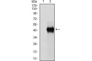 Western Blotting (WB) image for anti-Plasminogen Activator Inhibitor 1 (SERPINE1) antibody (ABIN969566)