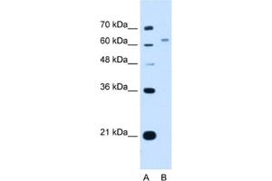 Western Blotting (WB) image for anti-WSC Domain Containing 2 (WSCD2) antibody (ABIN2463039) (WSCD2 antibody)