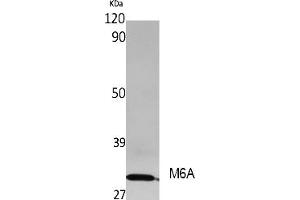 Western Blot analysis of extracts from rat stomach, using M6A Polyclonal Antibody. (METTL3 antibody  (AA 140-220))