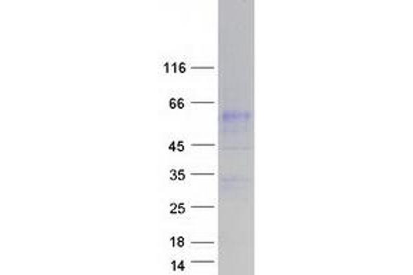 SLC34A3 Protein (Myc-DYKDDDDK Tag)