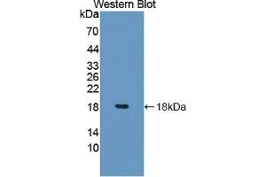 Detection of Recombinant PDCD5, Human using Polyclonal Antibody to Programmed Cell Death Protein 5 (PDCD5) (PDCD5 antibody  (AA 2-125))