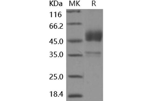 BMPR1B Protein (Fc Tag)