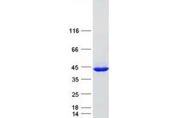 DCPS Protein (Myc-DYKDDDDK Tag)