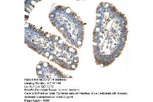 Rabbit Anti-MGC42174 Antibody  Paraffin Embedded Tissue: Human Intestine Cellular Data: Epithelial cells of intestinal villas Antibody Concentration: 4. (DIS3L2 antibody  (N-Term))