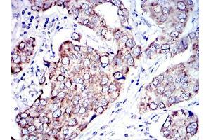 Immunohistochemistry (IHC) image for anti-Apoptosis-Inducing Factor, Mitochondrion-Associated, 1 (AIFM1) antibody (ABIN968950)