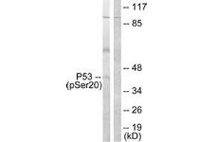 Western blot analysis of extracts from COS7 cells treated with UV 5', using p53 (Phospho-Ser20) Antibody. (p53 antibody  (pSer20))