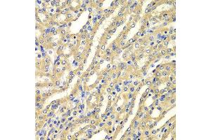 Immunohistochemistry of paraffin-embedded mouse kidney using WIPI2 antibody at dilution of 1:100 (x400 lens). (WIPI2 antibody)