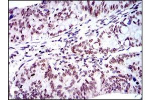 Immunohistochemistry (IHC) image for anti-BMI1 Polycomb Ring Finger Oncogene (BMI1) antibody (ABIN968985)