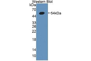 Western blot analysis of the recombinant protein. (GCK antibody  (AA 194-410))