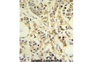 Immunohistochemistry (IHC) image for anti-Ribosomal Protein S13 (RPS13) antibody (ABIN3002137) (RPS13 antibody)