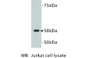 Image no. 1 for anti-Deoxynucleotidyltransferase, terminal (DNTT) antibody (ABIN1112828) (TdT antibody)