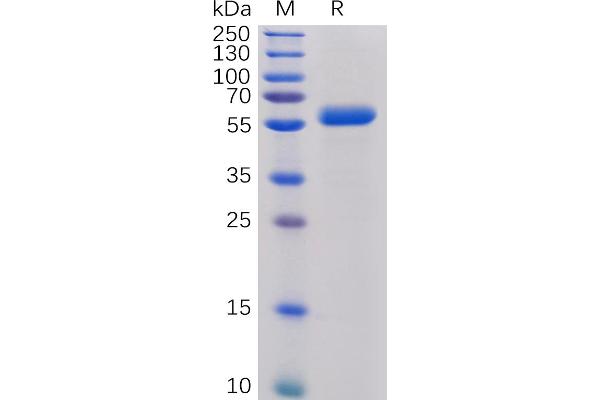 CTLA4 Protein (AA 36-161) (mFc-His Tag)