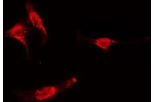 ABIN6275160 staining  Hela cells by IF/ICC. (GRB2 antibody  (C-Term))